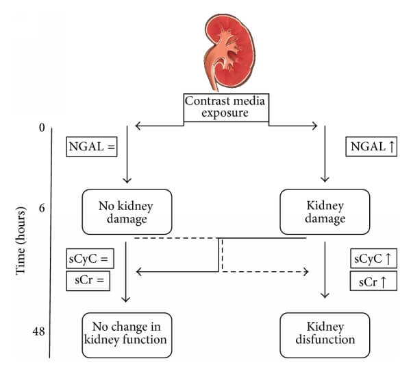CysC與NGAL、Cr的關(guān)系