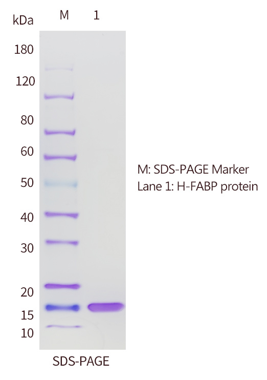 H-FABP抗原的SDS-PAGE分析圖